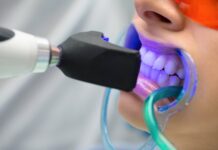 How Blue Light Technology is Enhancing Teeth Whitening? Teeth Whitening