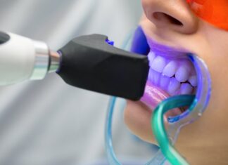 How Blue Light Technology is Enhancing Teeth Whitening? Teeth Whitening