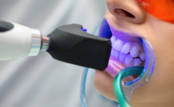How Blue Light Technology is Enhancing Teeth Whitening? Teeth Whitening