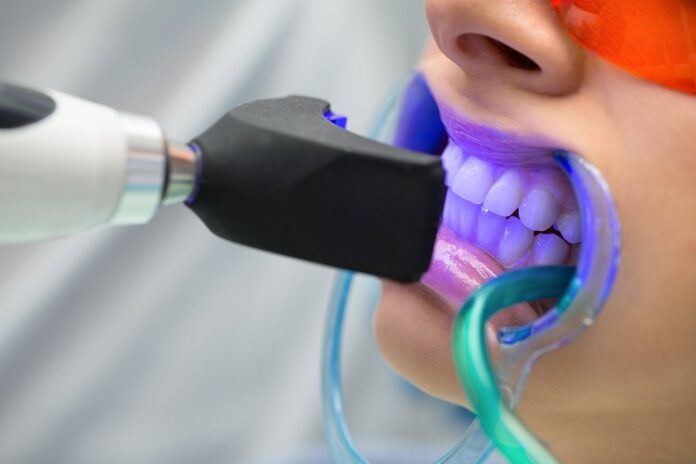 Teeth Whitening Teeth Whitening